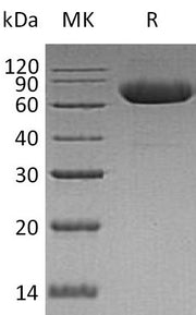 Recombinant Human LRRTM2 (C-6His)
