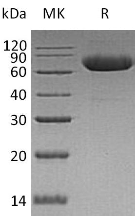 Recombinant Human LRRTM2 (C-6His)
