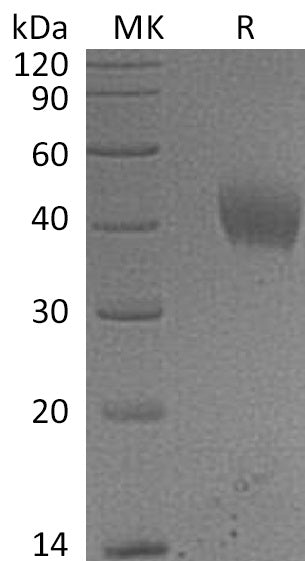 Recombinant Human IL-20RA (C-6His)