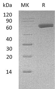 Recombinant Human EDIL3 (C-6His)