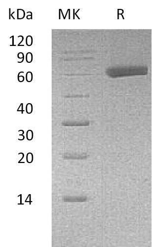 Recombinant Human EDIL3 (C-6His)