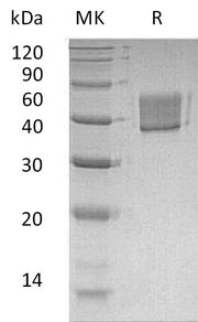 Recombinant Human FcRL1 (C-6His)