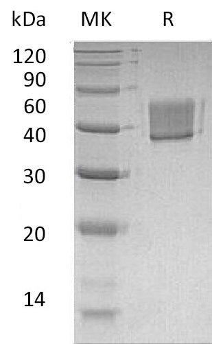 Recombinant Human FcRL1 (C-6His)