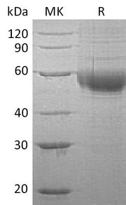 Recombinant Human PLA2G7 (C-6His)