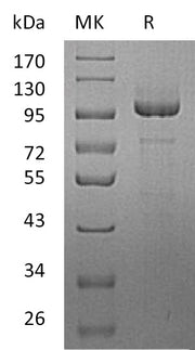 Recombinant Human PCDH10 (C-6His)