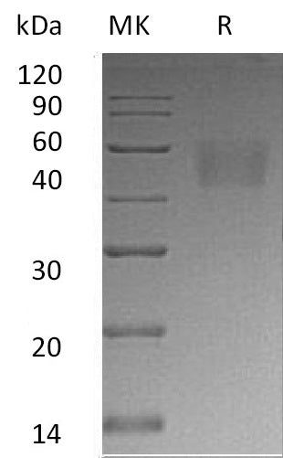 Recombinant Human Nectin-3 (C-6His)