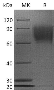 Recombinant Human CD30 (C-6His)