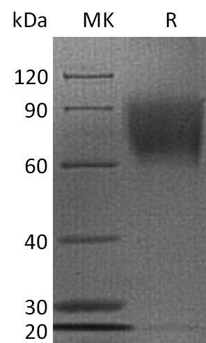 Recombinant Human CD30 (C-6His)