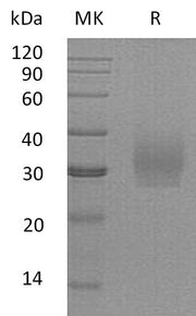 Recombinant Human SDC2 (C-6His)