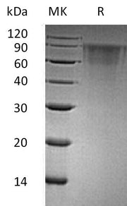Recombinant Human THSD1 (C-6His)