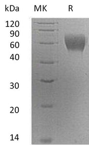 Recombinant Human Serpin A6 (C-6His)