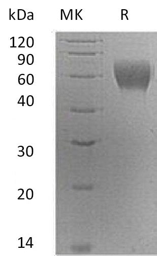 Recombinant Human Serpin A6 (C-6His)