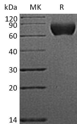 Recombinant Human NgR (C-6His)
