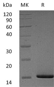 Recombinant Human SAA1 (N-6His)