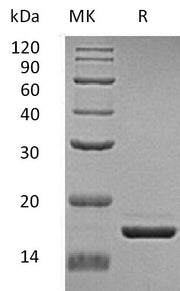 Recombinant Human ZG16 (C-6His)