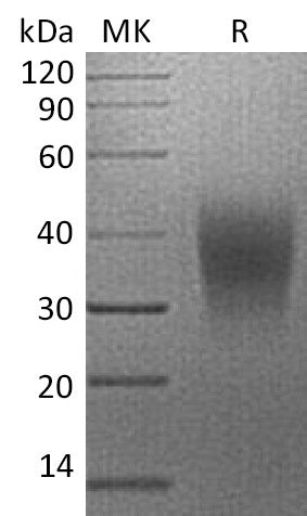 Recombinant Human VISTA (C-6His)