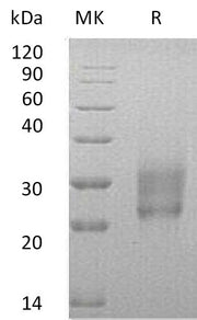 Recombinant Human HAI-2 (C-6His)