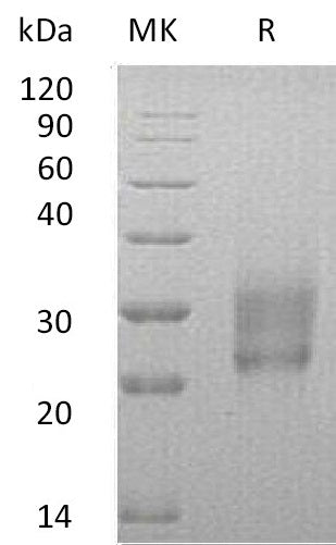 Recombinant Human HAI-2 (C-6His)