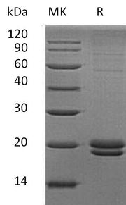 Recombinant Human VMO1 (C-6His)