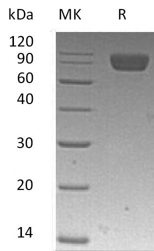 Recombinant Human PDGFRA (C-6His)