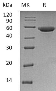 Recombinant Human LIPF (C-6His)