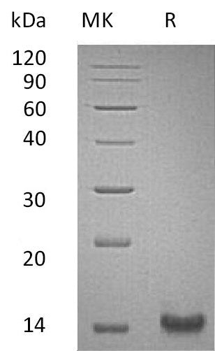 Recombinant Human TFF1 (C-6His)