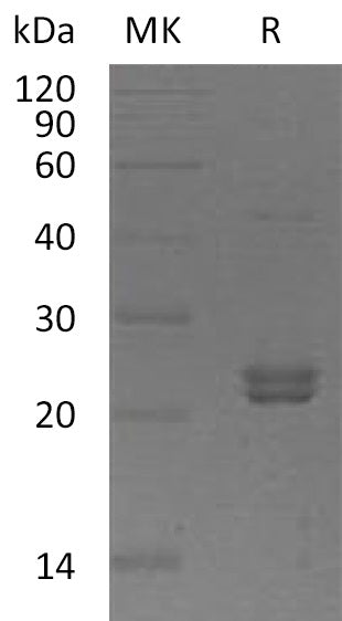 Recombinant Human ST6GalNAc2 (C-6His)