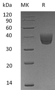 Recombinant Human CD157 (C-6His)
