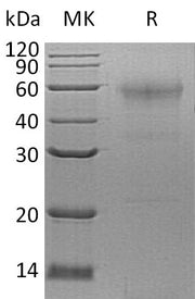 Recombinant Human SPESP1 (C-6His)