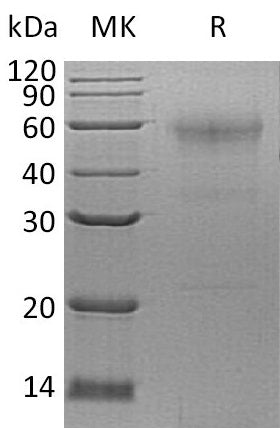 Recombinant Human SPESP1 (C-6His)