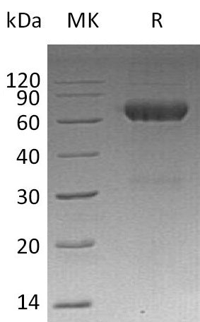 Recombinant Mouse MMP-12 (C-6His)