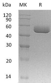 Recombinant Mouse Serpin A1a (C-6His, AAC28869.1)