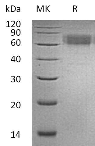 Recombinant Human IL-6RA (C-6His)