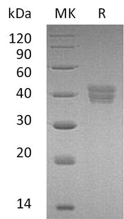 Recombinant Human HTRA2 (C-6His)