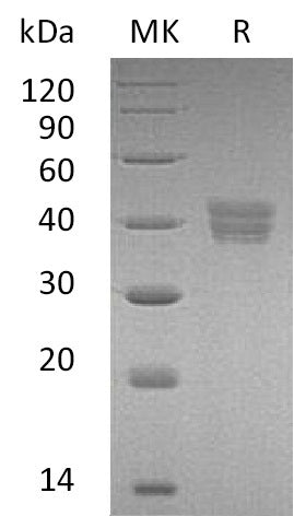 Recombinant Human HTRA2 (C-6His)