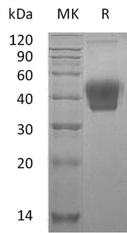 Recombinant Mouse M-CSF (C-6His)