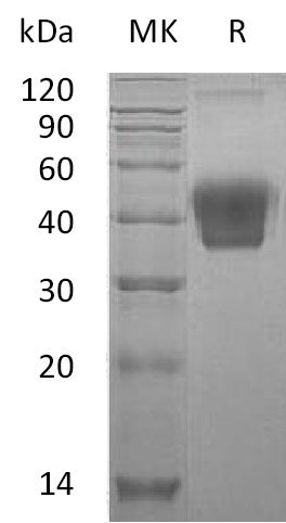 Recombinant Mouse M-CSF (C-6His)