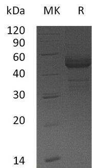 Recombinant Human TDGF1 (C-Fc)
