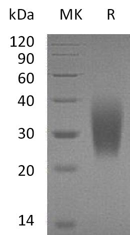 Recombinant Human PTH1R (C-6His)