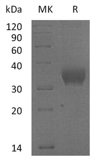 Recombinant Human SLAMF8 (C-6His)