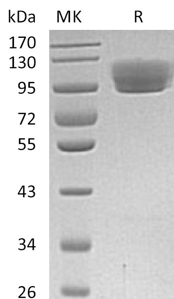 Recombinant Human ROBO4 (C-Fc)