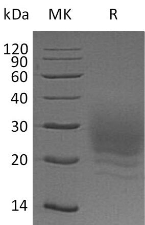 Recombinant Human BOC (C-6His)