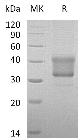 Recombinant Human TNF RII (174AA, C-6His)