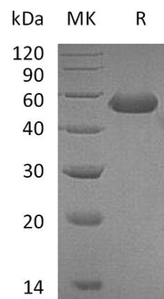 Recombinant Mouse CD5L (C-6His)