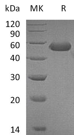 Recombinant Mouse CD5L (C-6His)