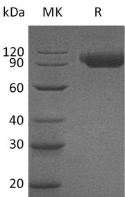 Recombinant Human Siglec-9 (C-Fc)