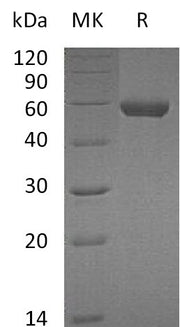 Recombinant Mouse CPM (C-6His)