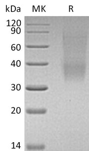 Recombinant Mouse SLAMF9 (C-6His)