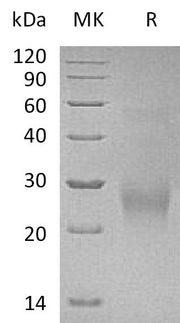 Recombinant Human CDK2AP2 (C-6His)
