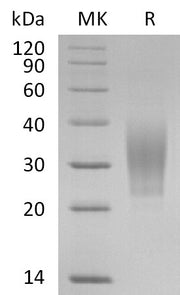 Recombinant Human TREM-2 (C-6His)